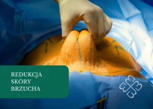 redukcja skóry brzucha