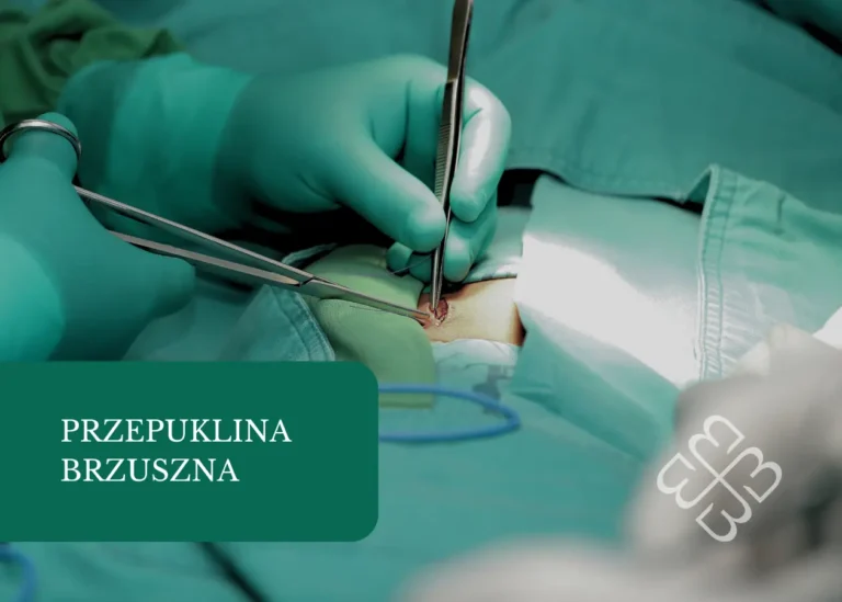 przepuklina brzuszna