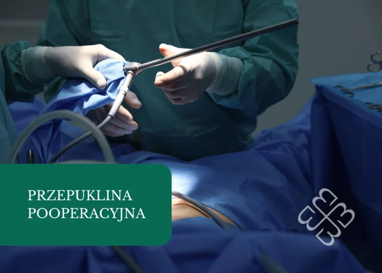 przepuklina pooperacyjna