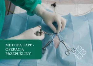 metoda tapp