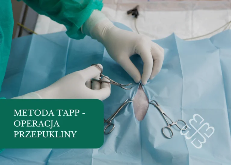 metoda tapp