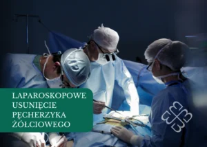Laparoskopowe usunięcie pęcherzyka żółciowego