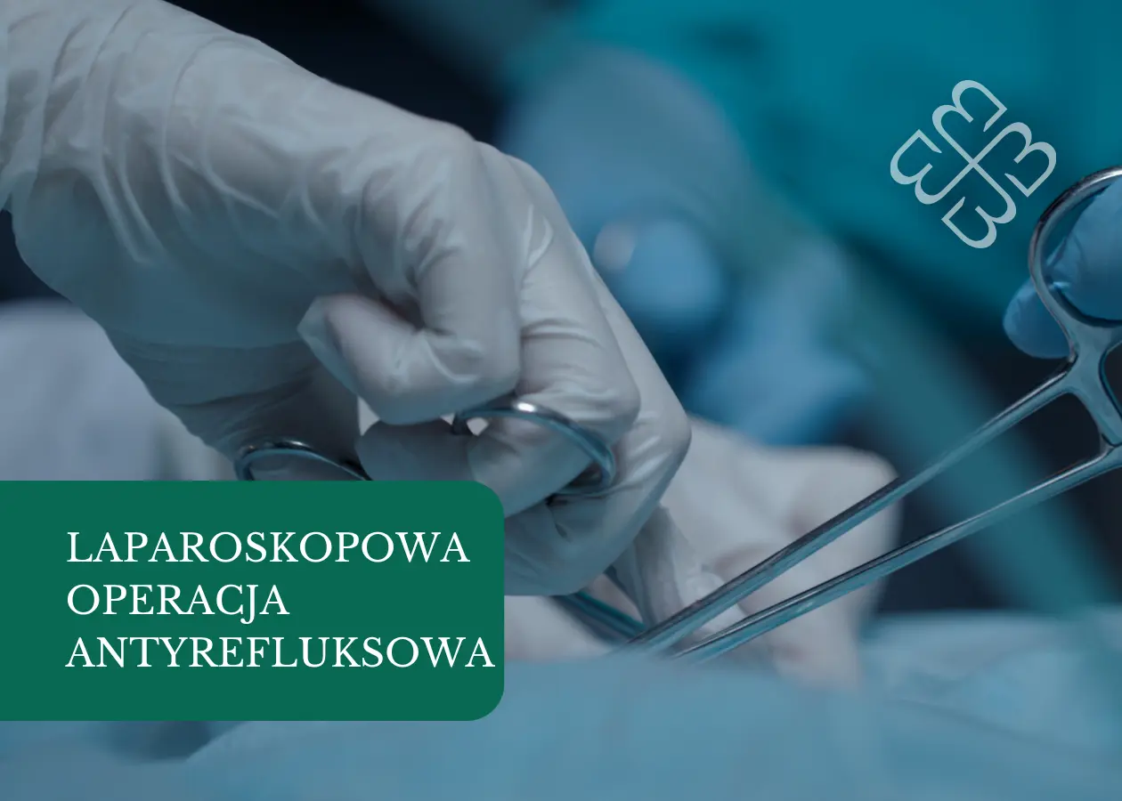 Laparoskopowa operacja antyrefluksowa